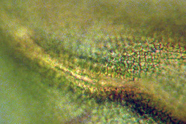 Anomodon attenuatus leaf cells