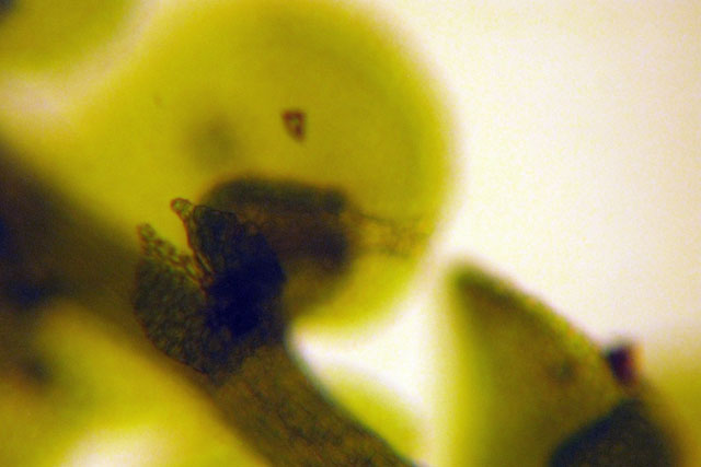 Frullania and rotifer