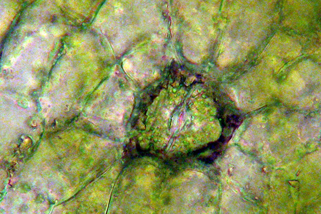 Orthotrichum stomate